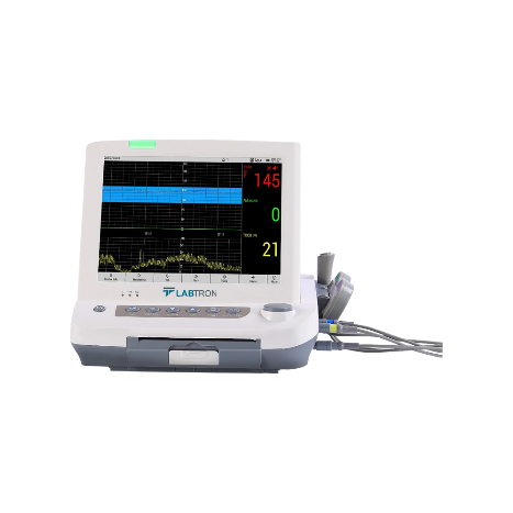 fetal monitor