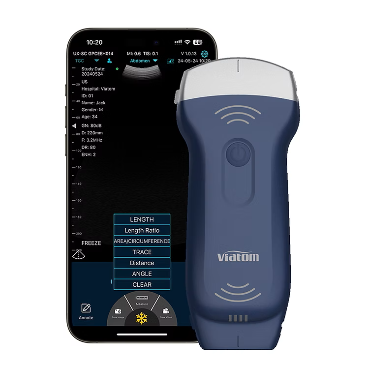 C10rl Handheld Ultrasound Scanner