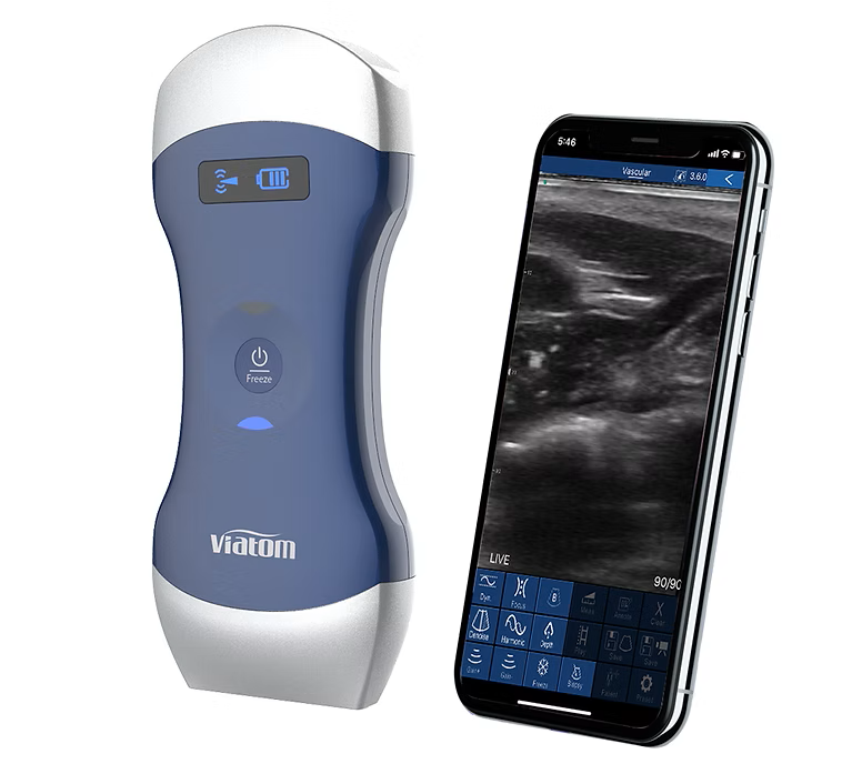 Dual-head Ultrasound Scanner of Viatom