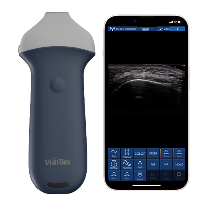 High-Frequency Linear Ultrasound